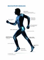 nejcastejsi-indikace